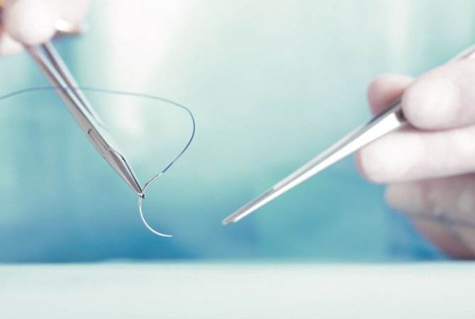 Einführung in Polypropylen Naht