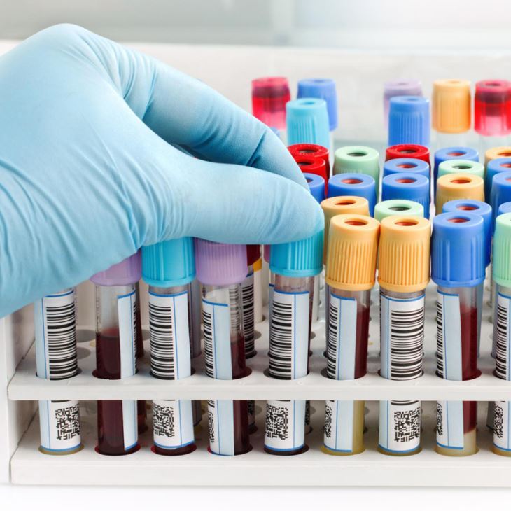 Einweg-Vakuum-BD-Vacutainer-Blutentnahmeröhrchen-Produktionslinie, Haustier-V...